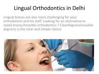 Lingual Orthodontics in Delhi