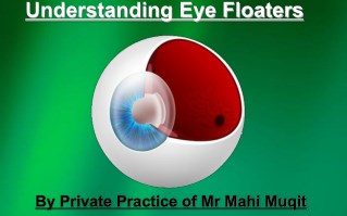 Understanding eye floaters