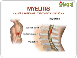 Myelitis