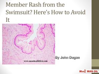 Member Rash from the Swimsuit? Here’s How to Avoid It