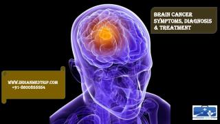 Brain Cancer-Symptoms,Diagnosis & Treatment