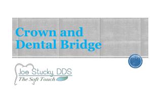 Crown and Dental Bridge