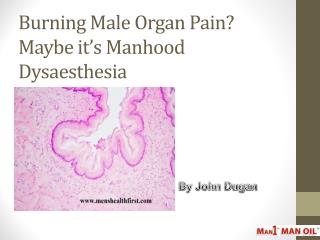 Burning Male Organ Pain? Maybe it’s Manhood Dysaesthesia