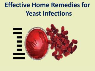 Effective home remedies for yeast infections