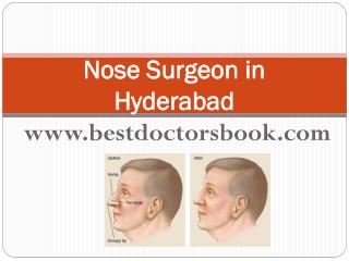 Nose Surgeon in Hyderabad |Rhinoplasty in Hyderabad