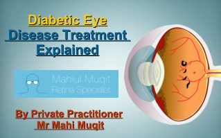 Diabetic Eye Disease Treatment Explained