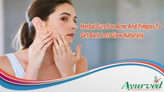 Herbal Cure For Acne And Pimples To Get Back Lost Glow Naturally