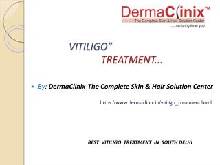 Best Vitiligo Treatment In South Delhi