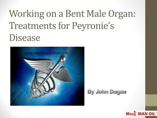 Working on a Bent Male Organ: Treatments for Peyronie’s Disease