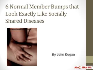 6 Normal Member Bumps that Look Exactly Like Socially Shared Diseases