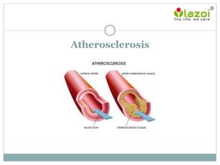 Atherosclerosis
