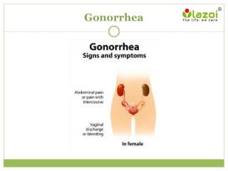 Gonorrhea: Overview, symptoms, causes, diagnosis, treatment and prevention