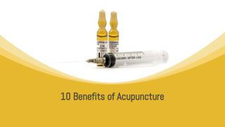 10 benefits of Acupuncture