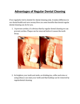 Advantages of Regular Dental Cleaning