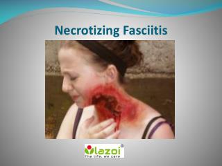 Necrotizing Fasciitis: Symptoms, Causes, Diagnosis and Treatment