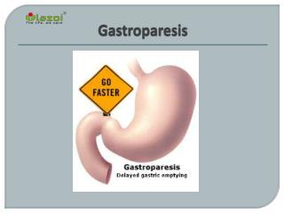 Gastroparesis: Causes, Symptoms, Diagnosis and Treatment