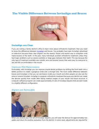 The Visible Difference Between Invisalign and Braces