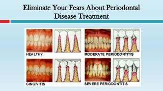 Eliminate Your Fears About Periodontal Disease Treatment