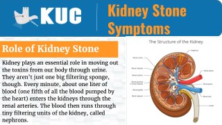 Impact of Kidney Stones on One’s Health