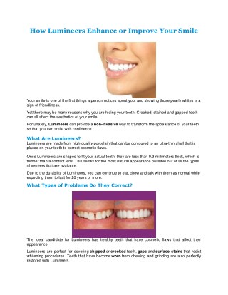 How Lumineers Enhance or Improve Your Smile