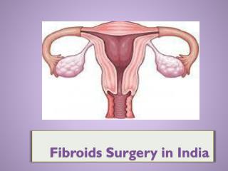 Fibroids Surgery in India