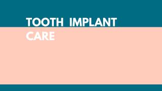 Tooth Implant Care