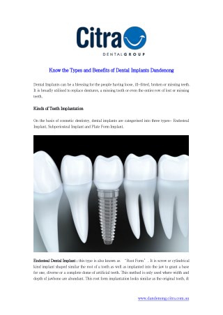 Know the Types and Benefits of Dental Implants Dandenong