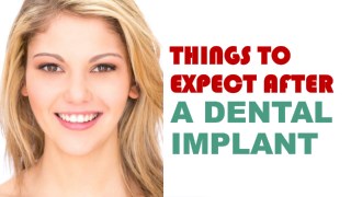 Things to Expect After a Dental Implant