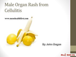 Male Organ Rash from Cellulitis