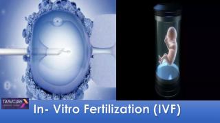 In Vitro Fertilization (IVF)