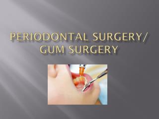 Periodontal Surgery/Gum Surgery By Best Periodontist in Pune – Dr. Ajwani