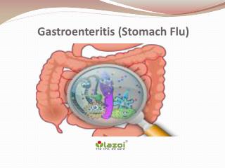 Gastroenteritis (Stomach Flu): Symptoms, causes, diagnosis and treatment