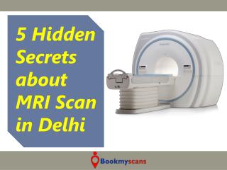 MRI Scan cost in Delhi - 5 Secrets Revealed that you MUST Know!