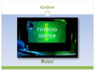 Goiter: Read about symptoms, causes and treatment
