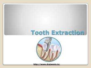 Tooth Extraction by Best Orthodontist in Pune – Dr. Ajwani