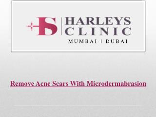 Remove Acne Scars With Microdermabrasion