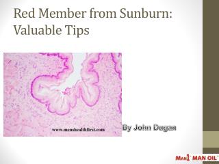 Red Member from Sunburn: Valuable Tips