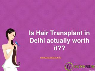 Is Hair Transplant Delhi Actually Worth it ?