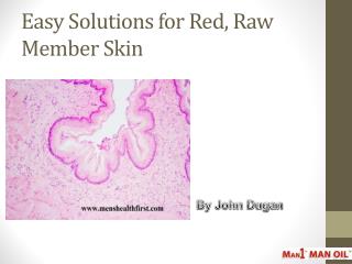 Easy Solutions for Red, Raw Member Skin