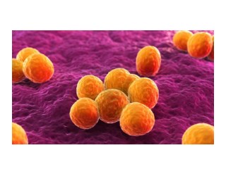 More People Die From Mrsa Than Aids, Mrsa Staph Infection, Staphylococcus Aureus, Mrsa Disease, Mrsa