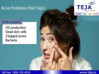 Acne Treatment @ Teja