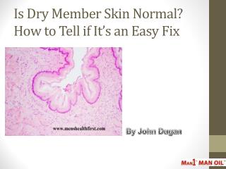 Is Dry Member Skin Normal? How to Tell if It’s an Easy Fix