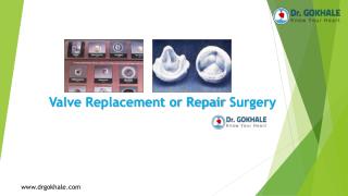 Valve Replacement or Repair Surgery by Dr. Gokhale