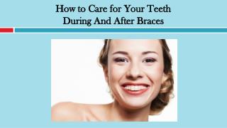 How to Care for Your Teeth During And After Braces