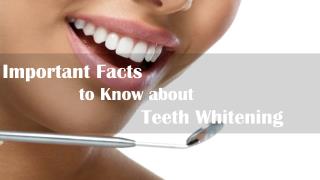 Important Facts to Know about Teeth Whitening