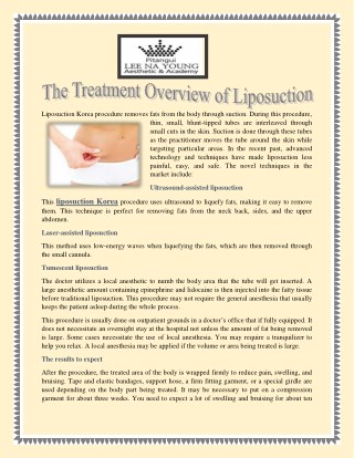Treatment Overview Of Liposuction