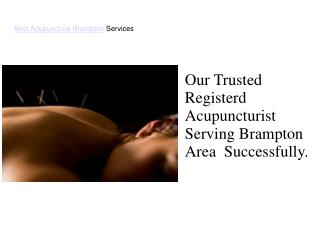 Best Acupuncture Brampton