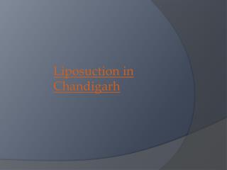 Gynecomastia Treatment in Chandigarh