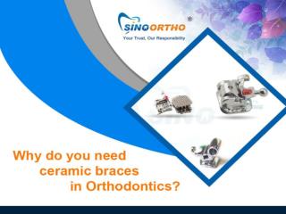 Why do you need ceramic braces in Orthodontics?