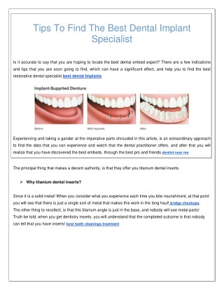 Tips To Find The Best Dental Implant Specialist